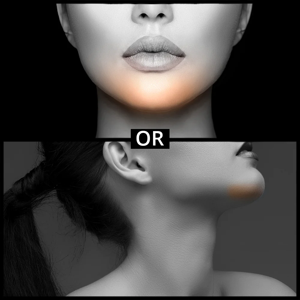 Chin Extension – Summer Sale