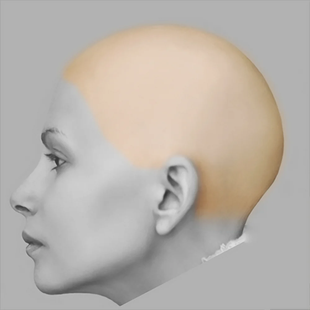 Scalp – Summer Sale