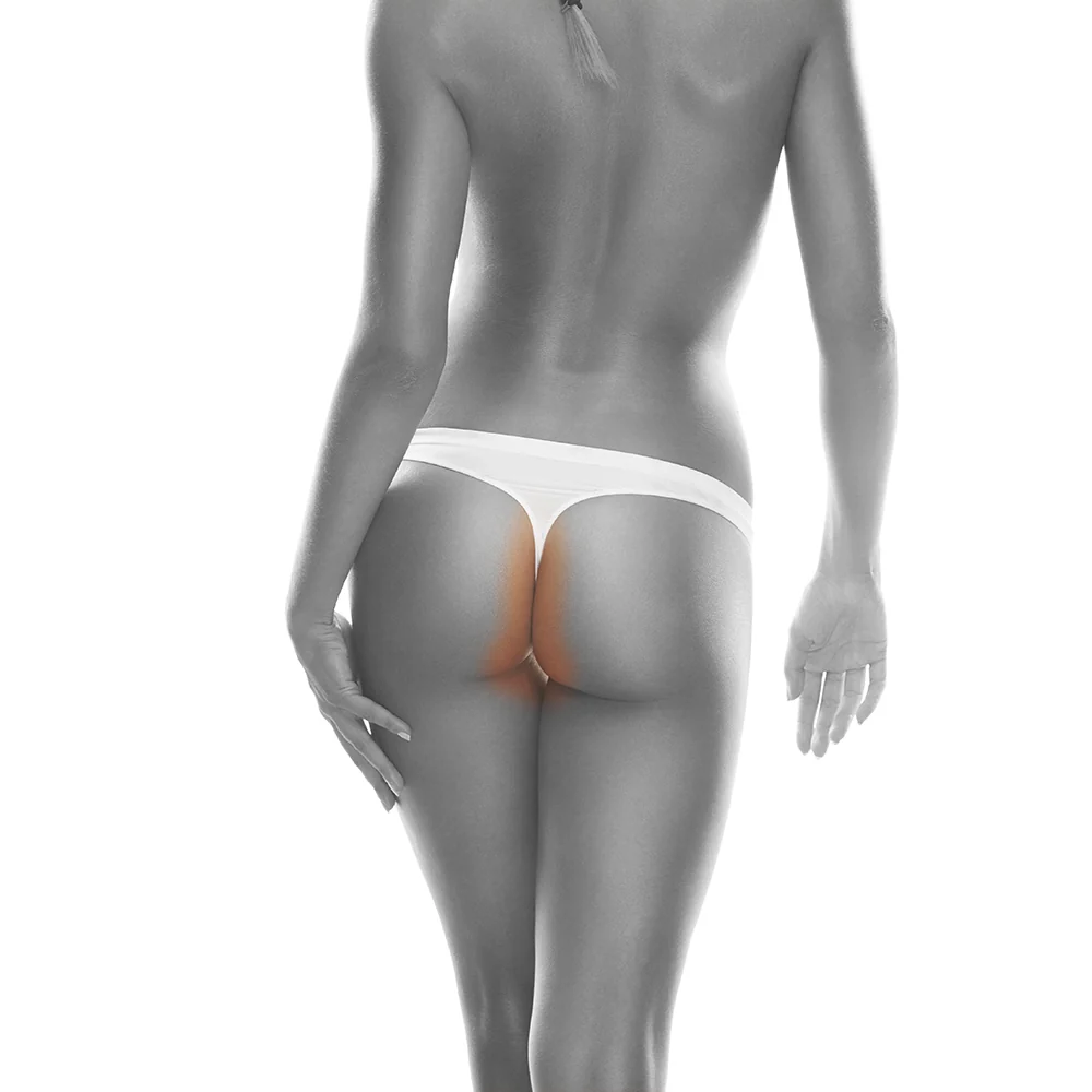 Thong Line – Summer Sale